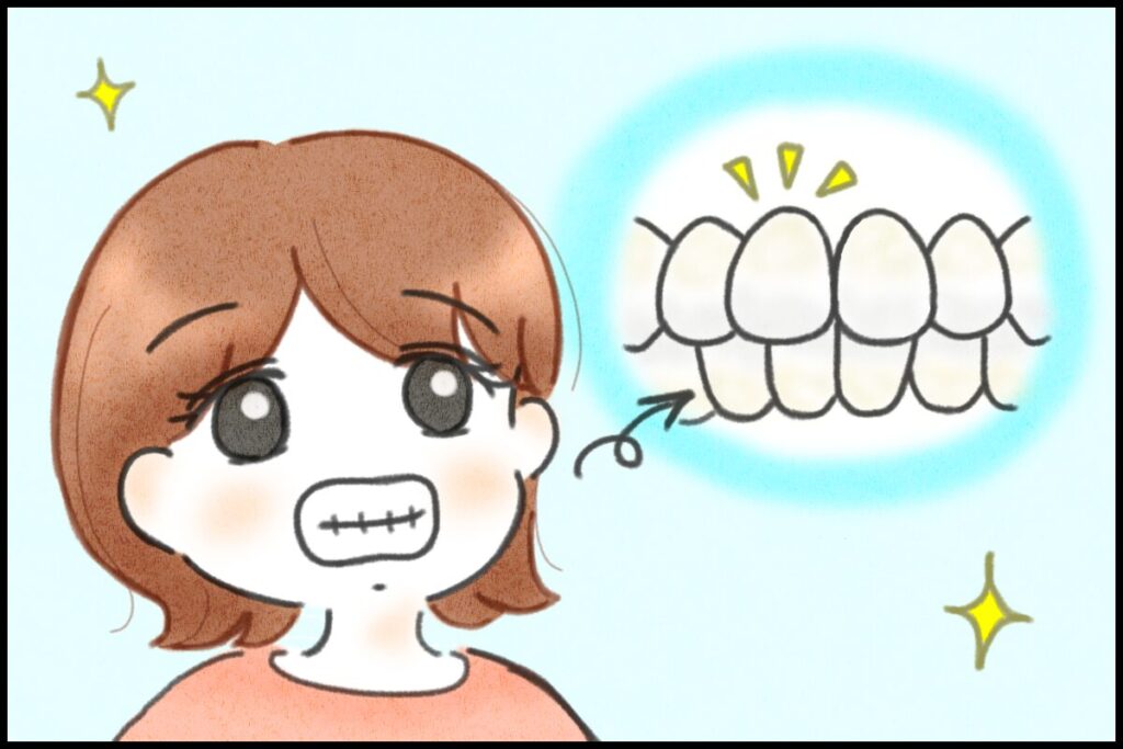 オールセラミッククラウンの被せ物をしてもらって完成度の高さに感動するぴのり